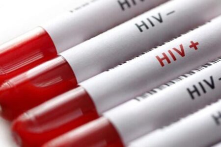 Türkiye’de HIV görülme yaşı 15’e kadar indi